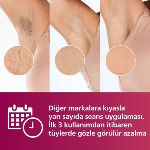 Philips Lumea Advanced BRI924/00 IPL Lazer Epilasyon Aleti - TEŞHİR